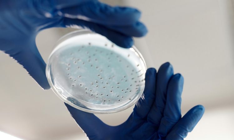 Conoce qué son las bacterias heterótrofas