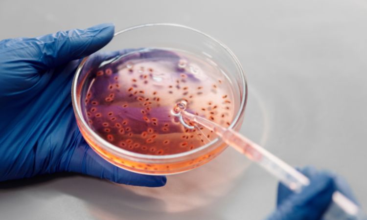Descubre los tipos y usos de los cultivos bacterianos