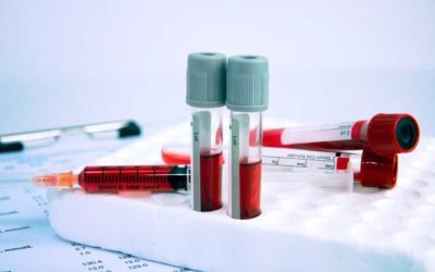 ¿Qué estudia la hematología?