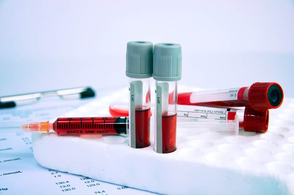 La hematología estudia la sangre y sus componentes