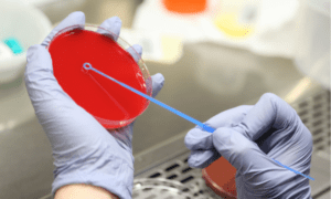 Método de identificación bacteriana en el entorno clínico actual